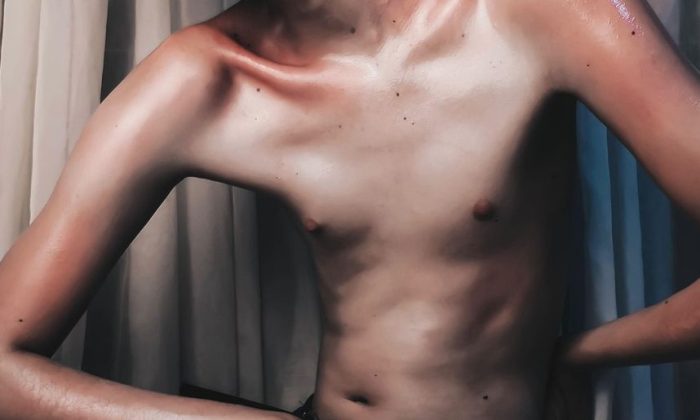 SkinnyTok, disciplinace, poruchy příjmu potravy, algoritmus TikToku, mladiství